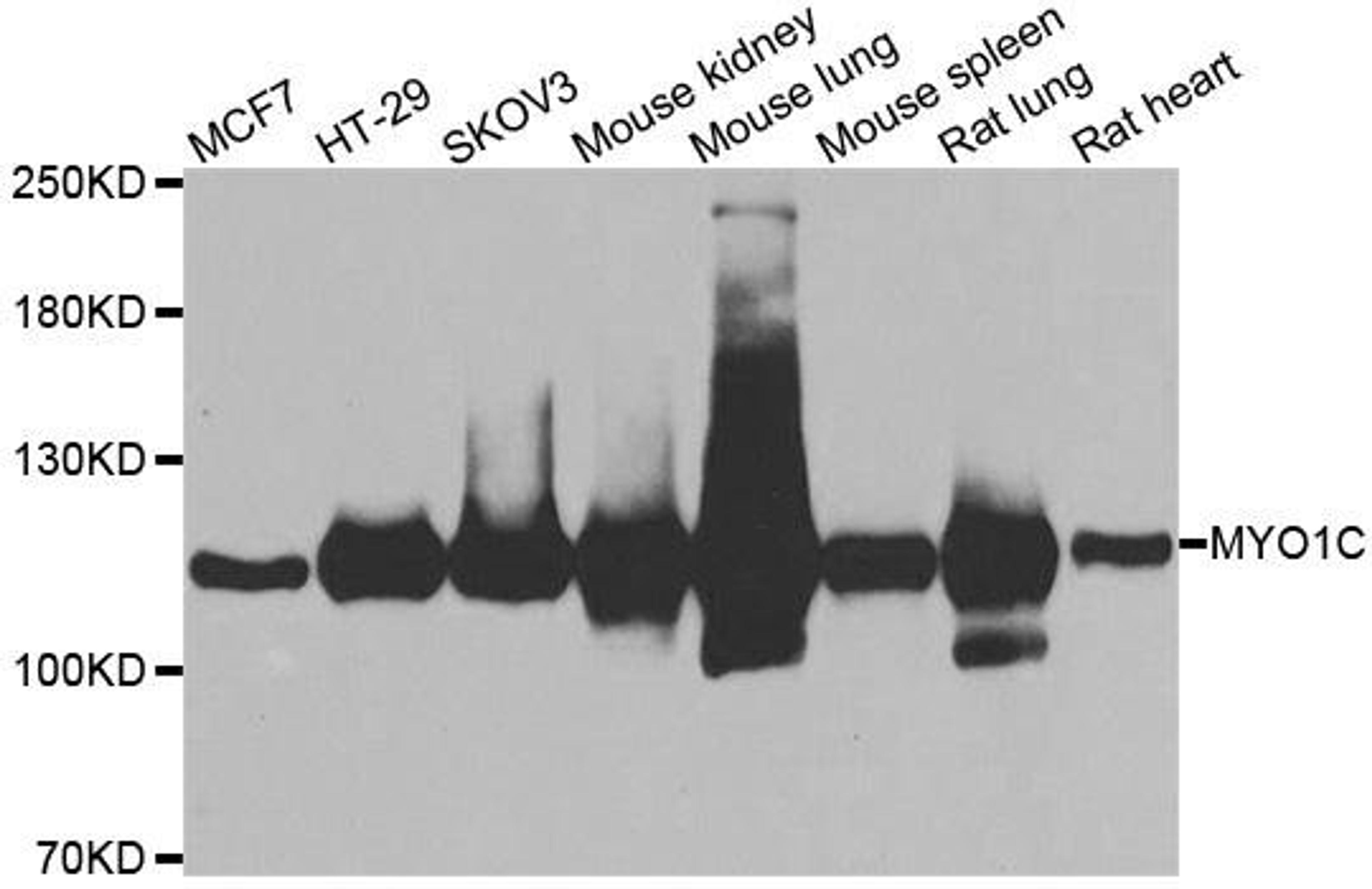 Western blot analysis of extracts of various cell lines using MYO1C antibody