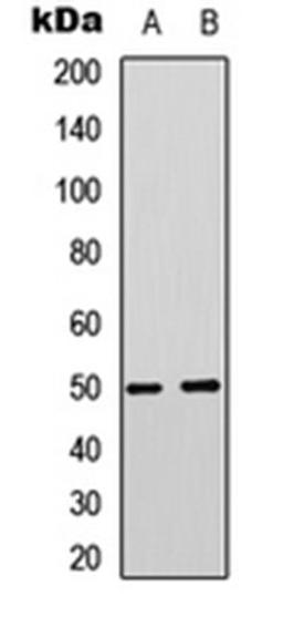 Western blot analysis of Jurkat (Lane 1), PC3 (Lane 2) whole cell lysates using MCT4 antibody