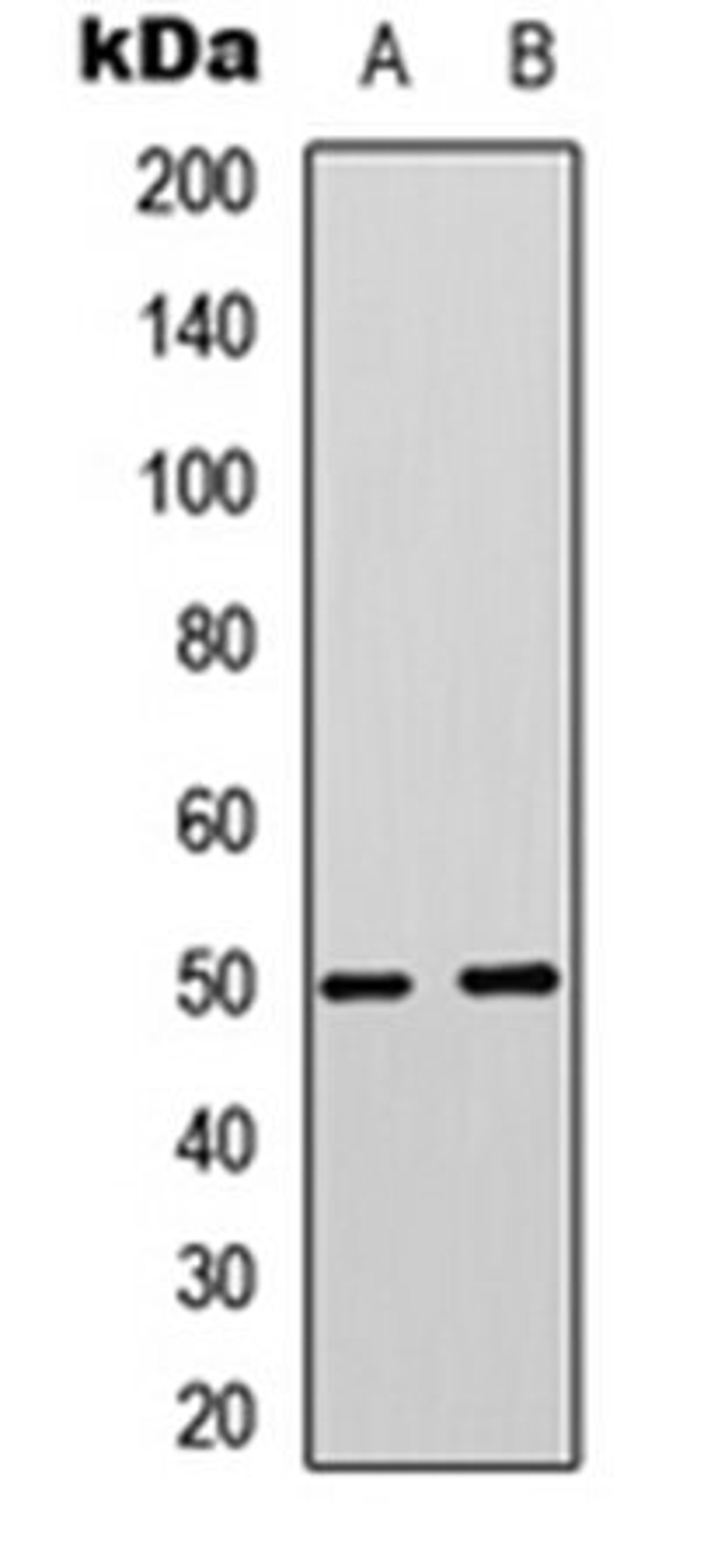 Western blot analysis of Jurkat (Lane 1), PC3 (Lane 2) whole cell lysates using MCT4 antibody