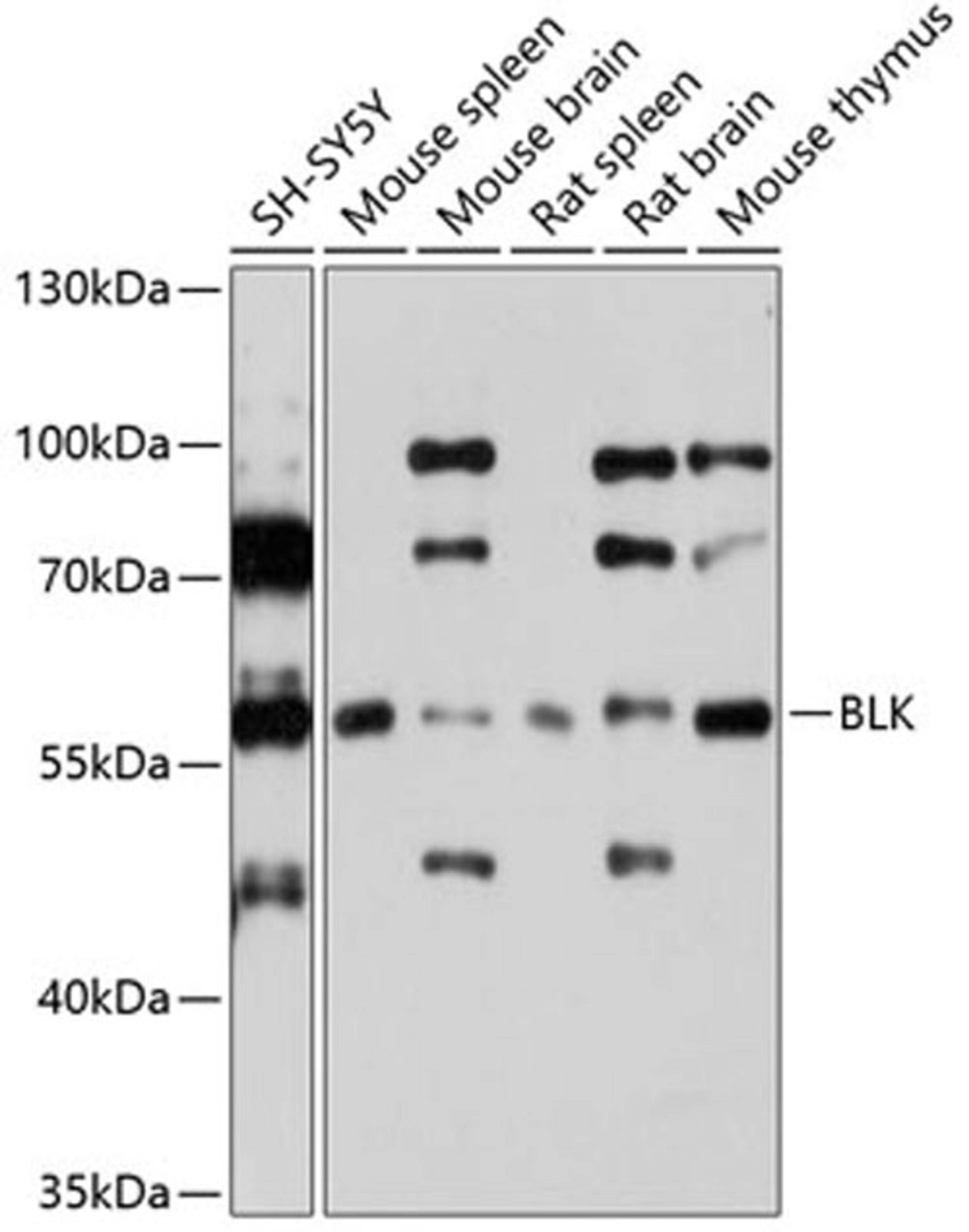 Western blot - BLK Antibody (A7427)