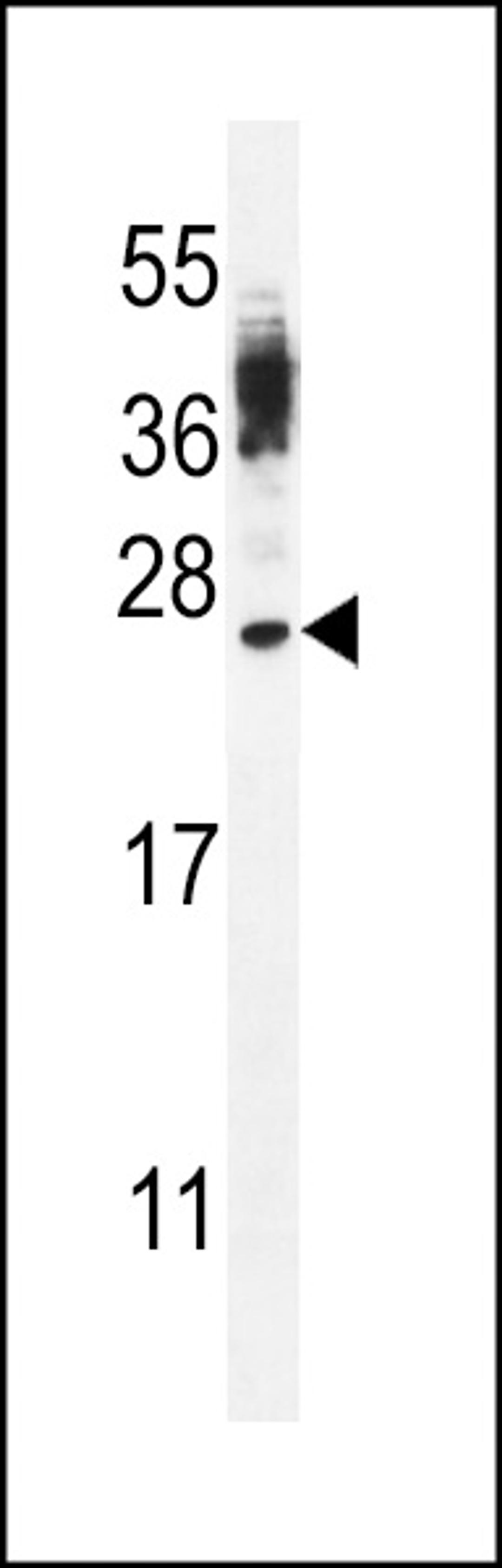 Western blot analysis in WiDr cell line lysates (35ug/lane).