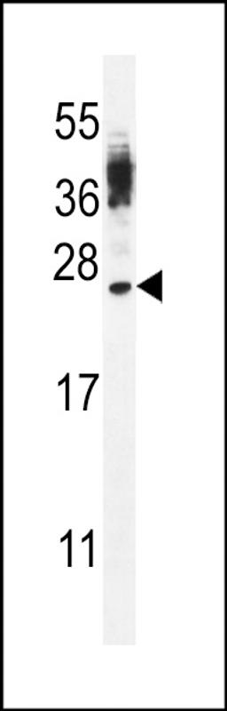 Western blot analysis in WiDr cell line lysates (35ug/lane).