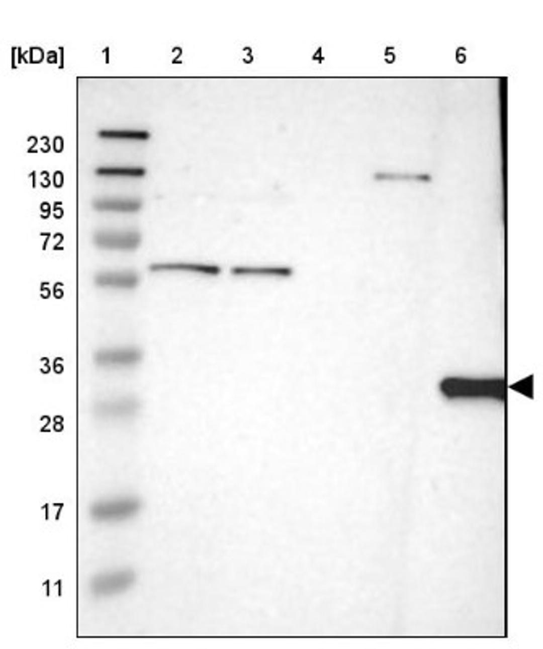 Western Blot: HLA DQB1 Antibody [NBP1-84549] - Lane 1: Marker [kDa] 230, 130, 95, 72, 56, 36, 28, 17, 11<br/>Lane 2: Human cell line RT-4<br/>Lane 3: Human cell line U-251MG sp<br/>Lane 4: Human plasma (IgG/HSA depleted)<br/>Lane 5: Human liver tissue<br/>Lane 6: Human tonsil tissue