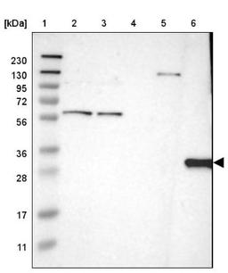 Western Blot: HLA DQB1 Antibody [NBP1-84549] - Lane 1: Marker [kDa] 230, 130, 95, 72, 56, 36, 28, 17, 11<br/>Lane 2: Human cell line RT-4<br/>Lane 3: Human cell line U-251MG sp<br/>Lane 4: Human plasma (IgG/HSA depleted)<br/>Lane 5: Human liver tissue<br/>Lane 6: Human tonsil tissue