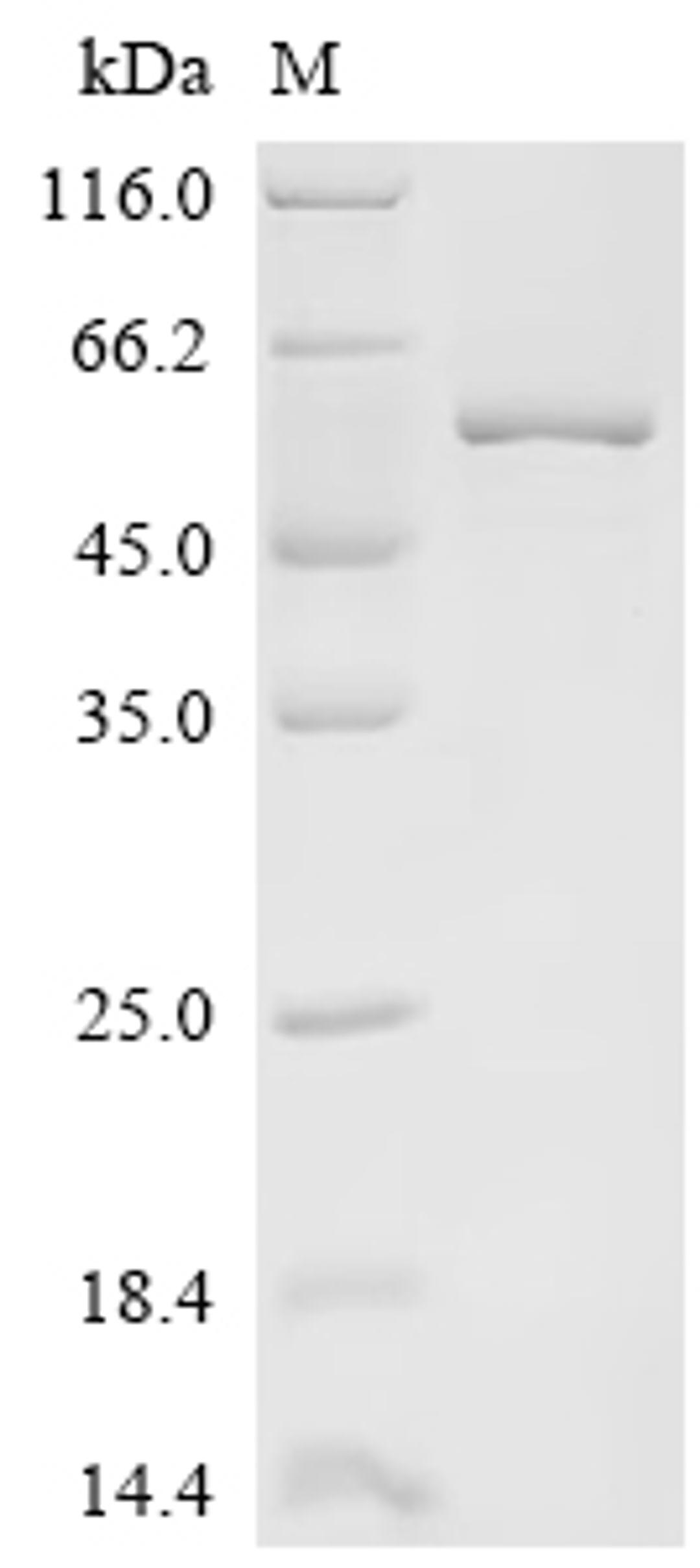 (Tris-Glycine gel) Discontinuous SDS-PAGE (reduced) with 5% enrichment gel and 15% separation gel.
