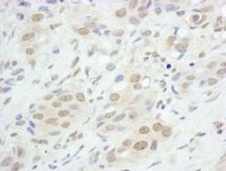 Detection of human JunB by immunohistochemistry.