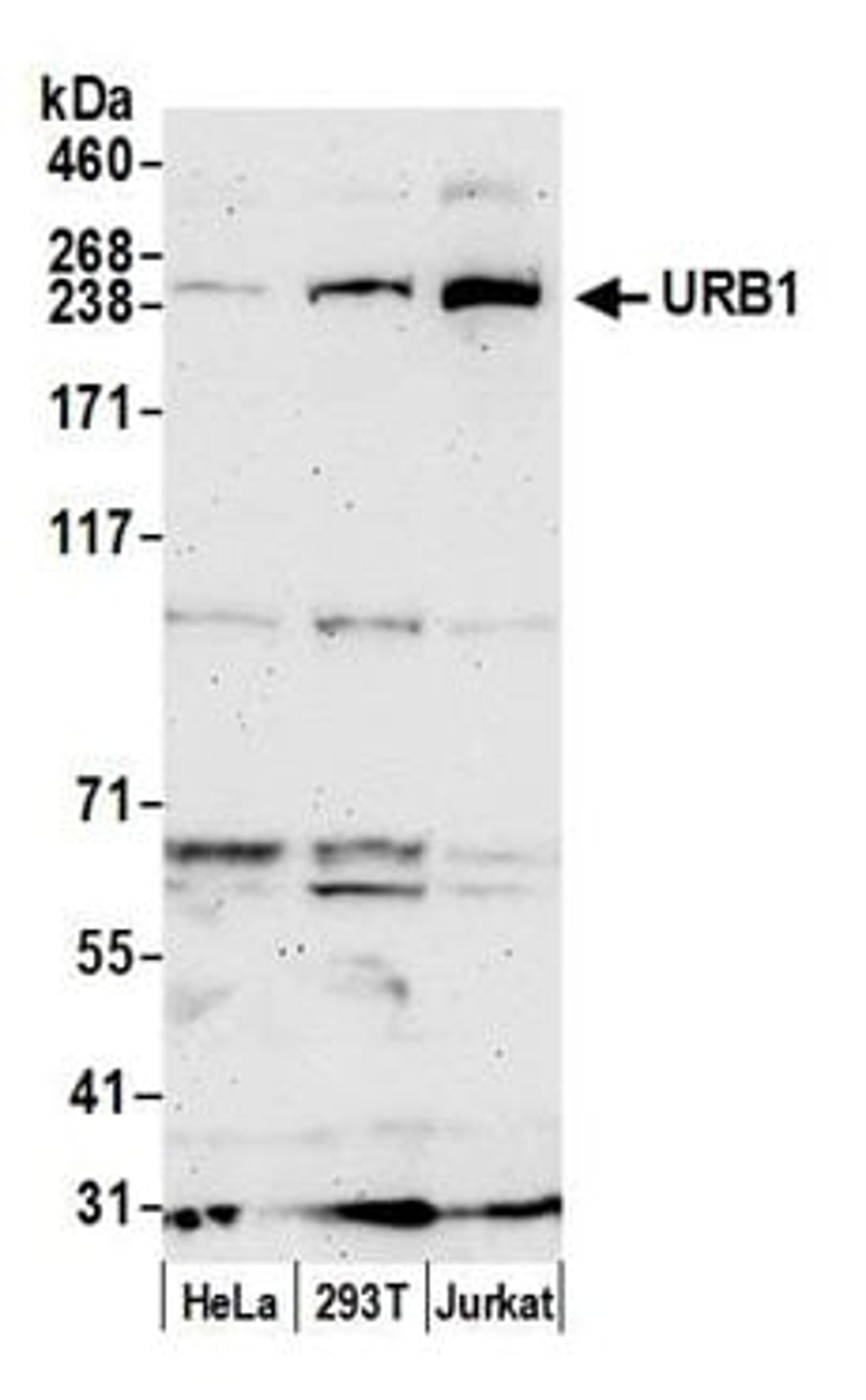 Detection of human URB1 by western blot.