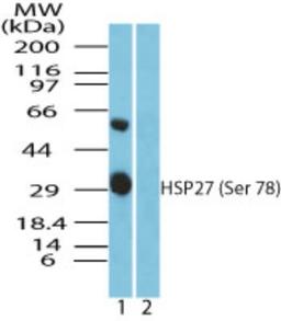 Western Blot: Hsp27 [p Ser78] Antibody [NBP2-24458] - analysis of HSP27 (Ser78) in recombinant fusion protein containing 1) a phosphorylated serine at position 78 and 2) an unphosphorylated serine at position 78, using HSP27 phospho antibody at 0.01 ug/ml.  Goat anti-rabbit Ig HRP secondary antibody and PicoTect ECL substrate solution were used for this test.