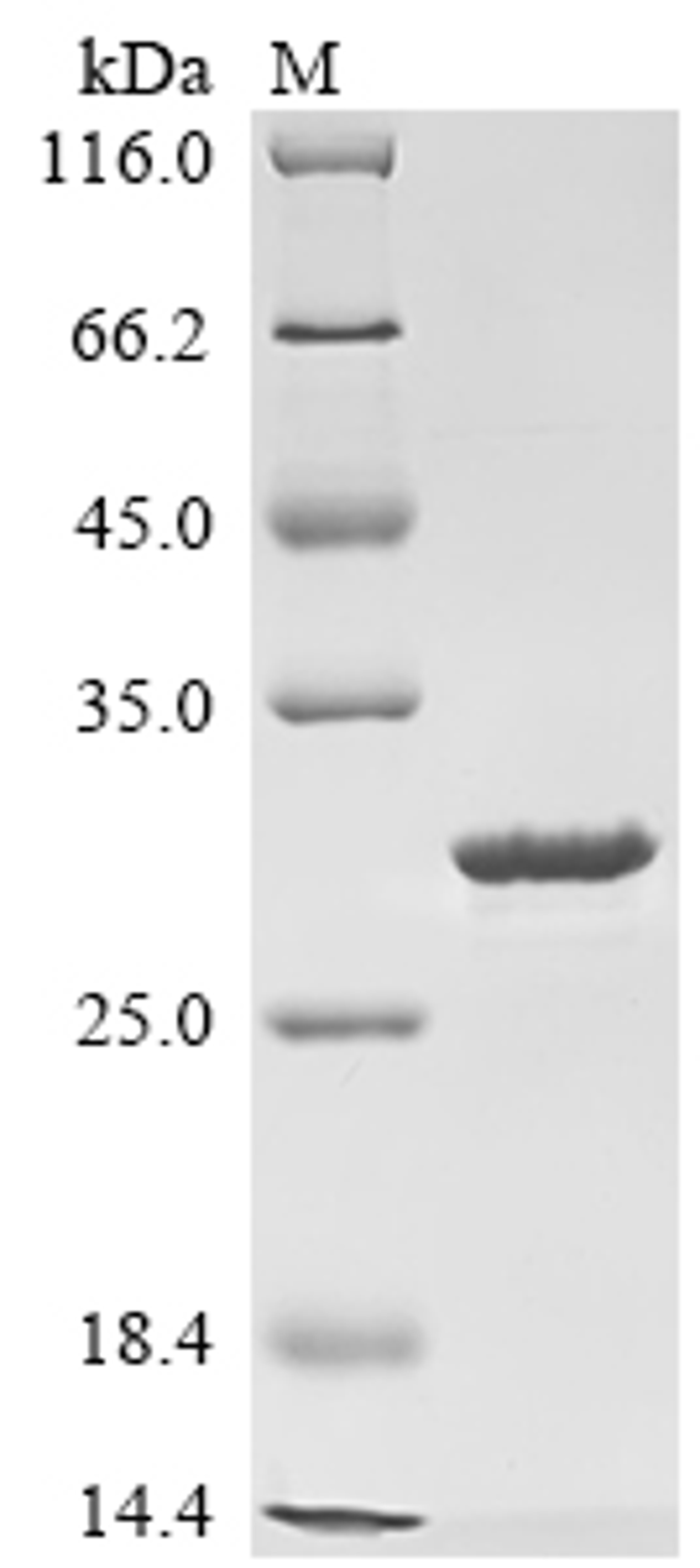 (Tris-Glycine gel) Discontinuous SDS-PAGE (reduced) with 5% enrichment gel and 15% separation gel.