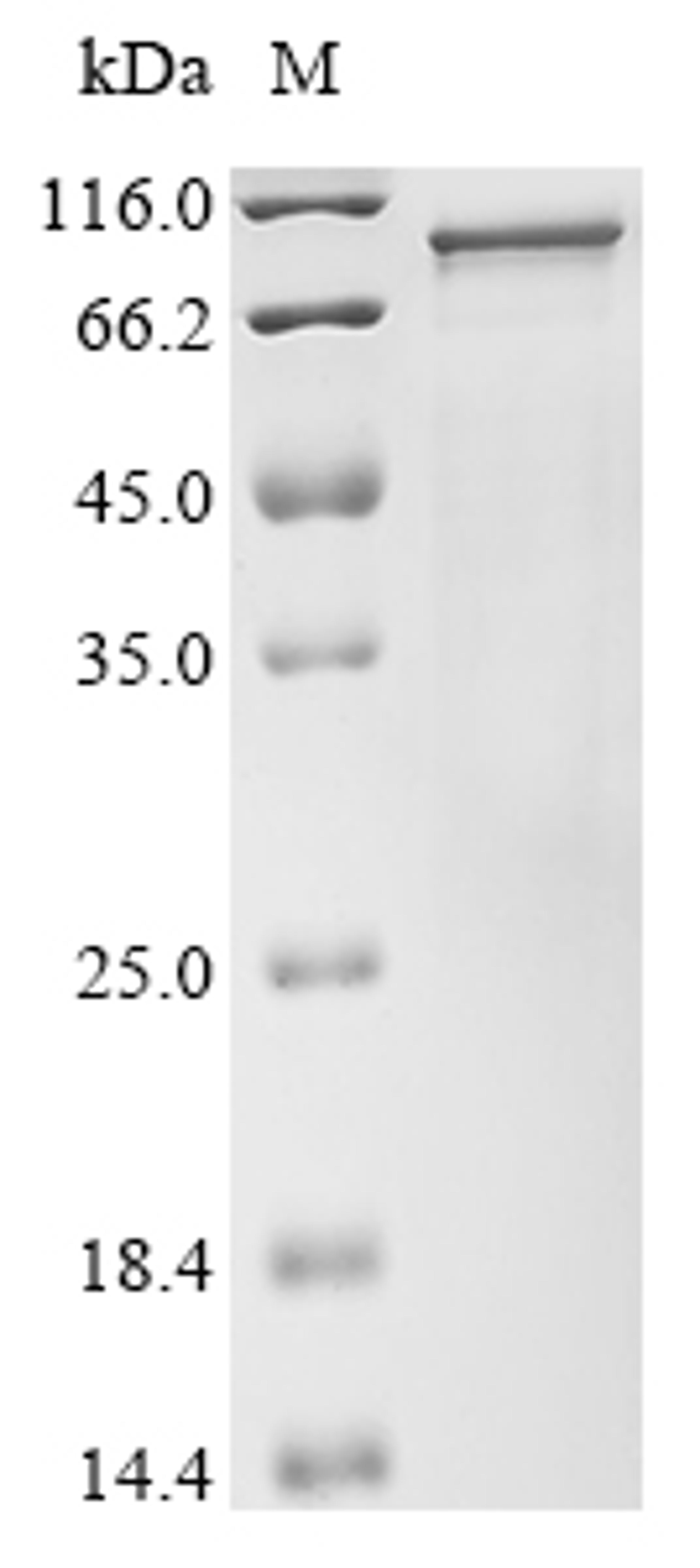 (Tris-Glycine gel) Discontinuous SDS-PAGE (reduced) with 5% enrichment gel and 15% separation gel.