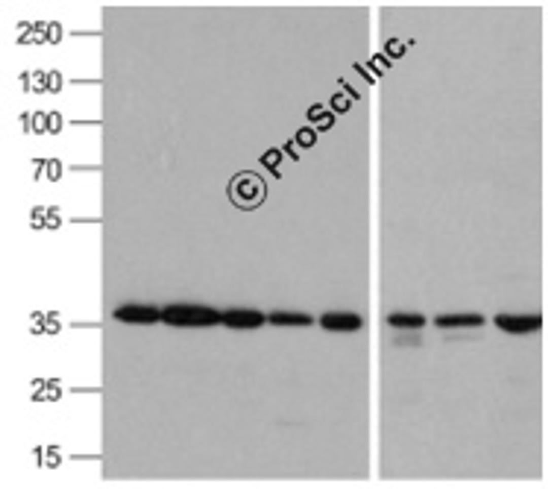 Western blot analysis of GAPDH in A431, Daudi, HepG2, HL60, Jurkat, Human kidney, Mouse lung, and Chicken liver lysate with GAPDH antibody 0.5 μg/mL.