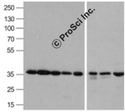 Western blot analysis of GAPDH in A431, Daudi, HepG2, HL60, Jurkat, Human kidney, Mouse lung, and Chicken liver lysate with GAPDH antibody 0.5 μg/mL.