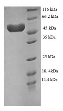 (Tris-Glycine gel) Discontinuous SDS-PAGE (reduced) with 5% enrichment gel and 15% separation gel.