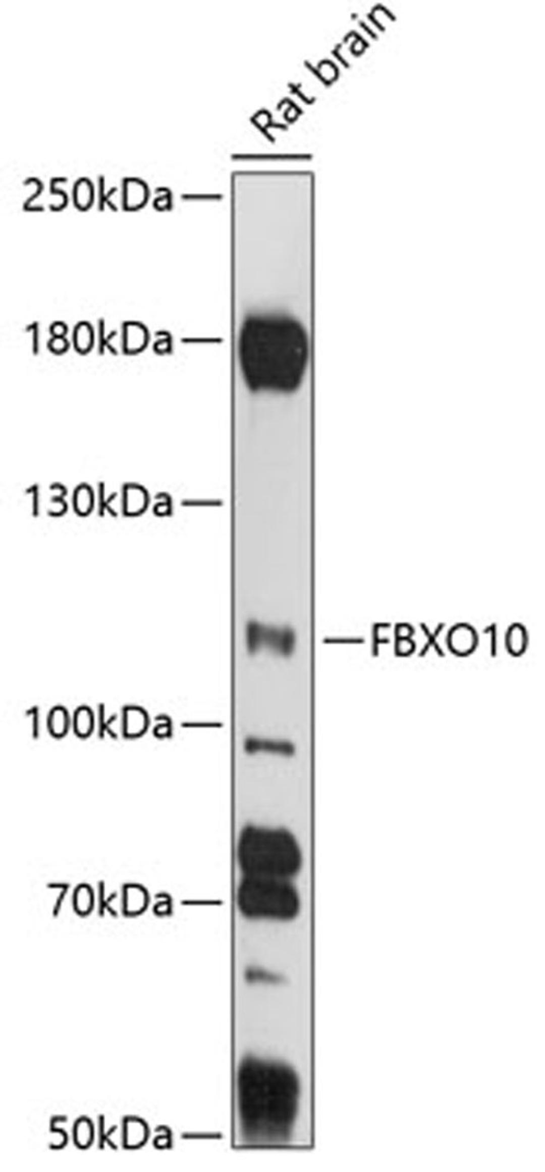 Western blot - FBXO10 antibody (A14871)