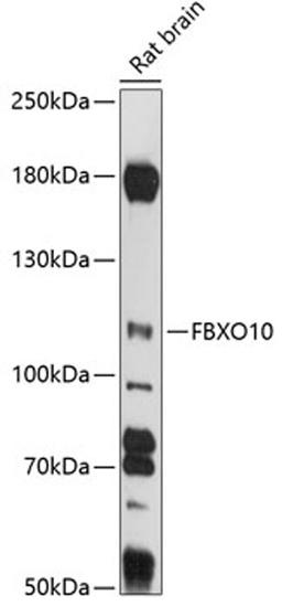 Western blot - FBXO10 antibody (A14871)