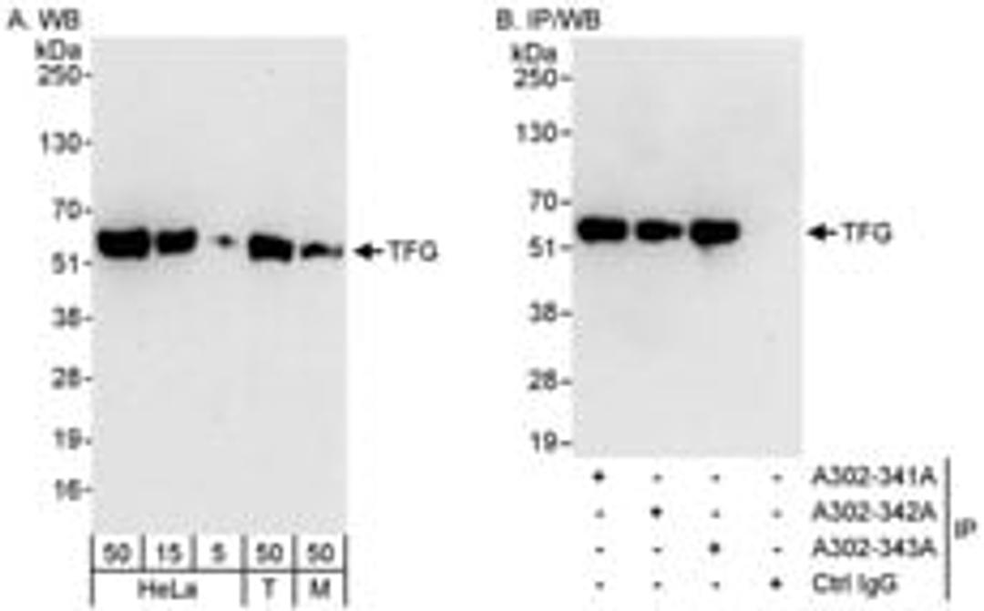 Detection of human and mouse TFG by western blot (h&m) and immunoprecipitation (h).