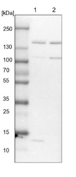 Western Blot: SUPT5H Antibody [NBP1-83508] - Lane 1: NIH-3T3 cell lysate (Mouse embryonic fibroblast cells)<br/>Lane 2: NBT-II cell lysate (Rat Wistar bladder tumour cells)