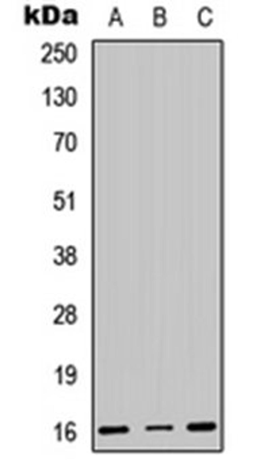 Western blot analysis of HEK293T (Lane 1), Raw264.7 (Lane 2), H9C2 (Lane 3) whole cell lysates using CENPA antibody