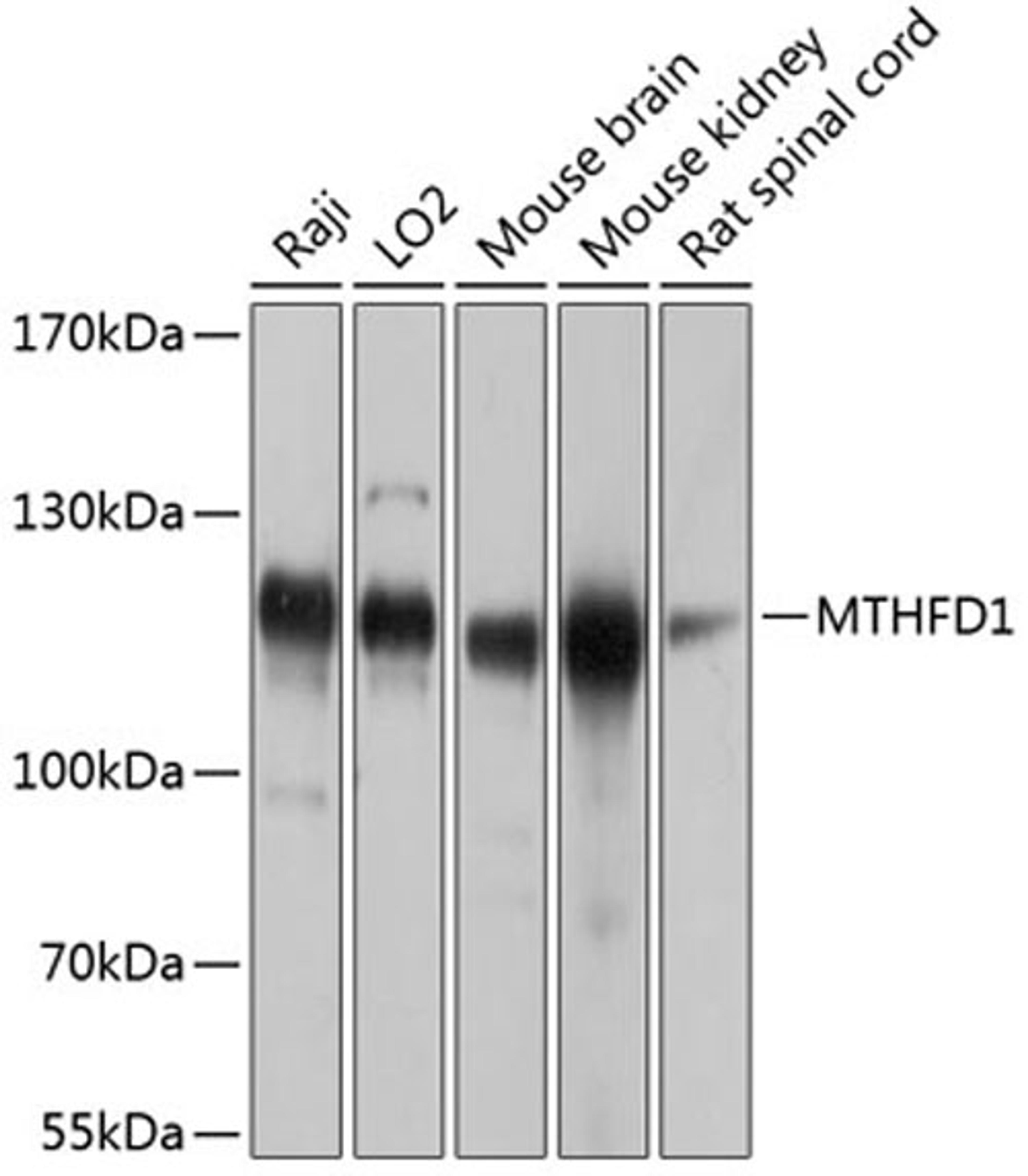 Western blot - MTHFD1 antibody (A8661)