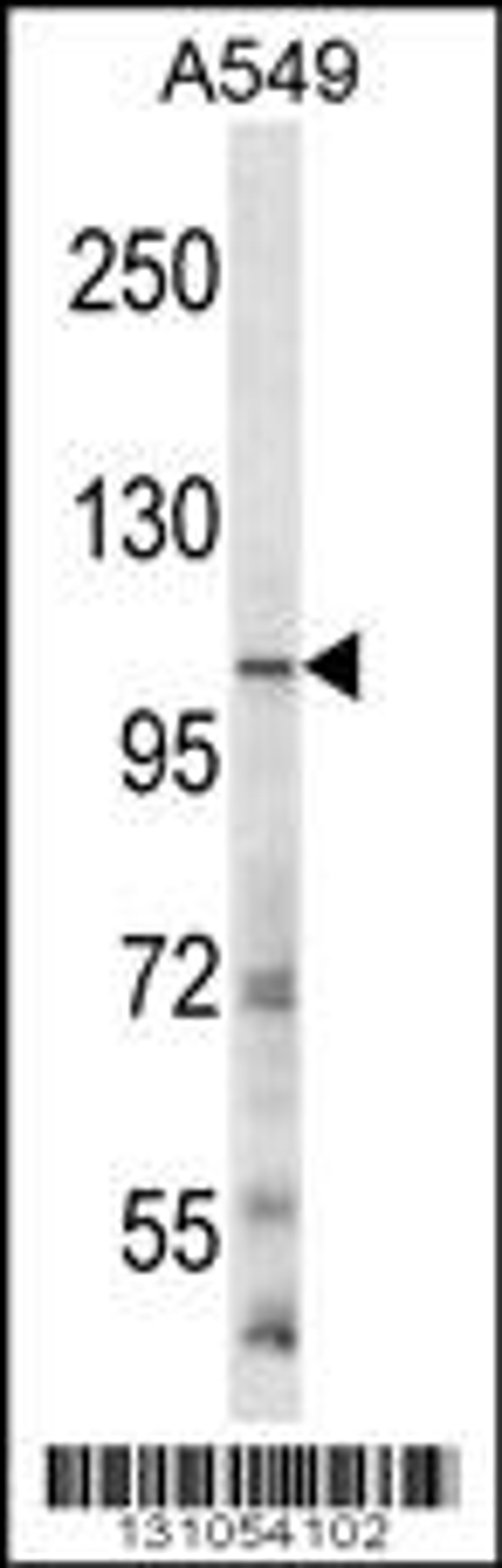 Western blot analysis in A549 cell line lysates (35ug/lane).