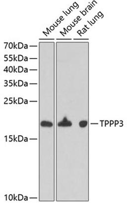 Western blot - TPPP3 antibody (A6775)