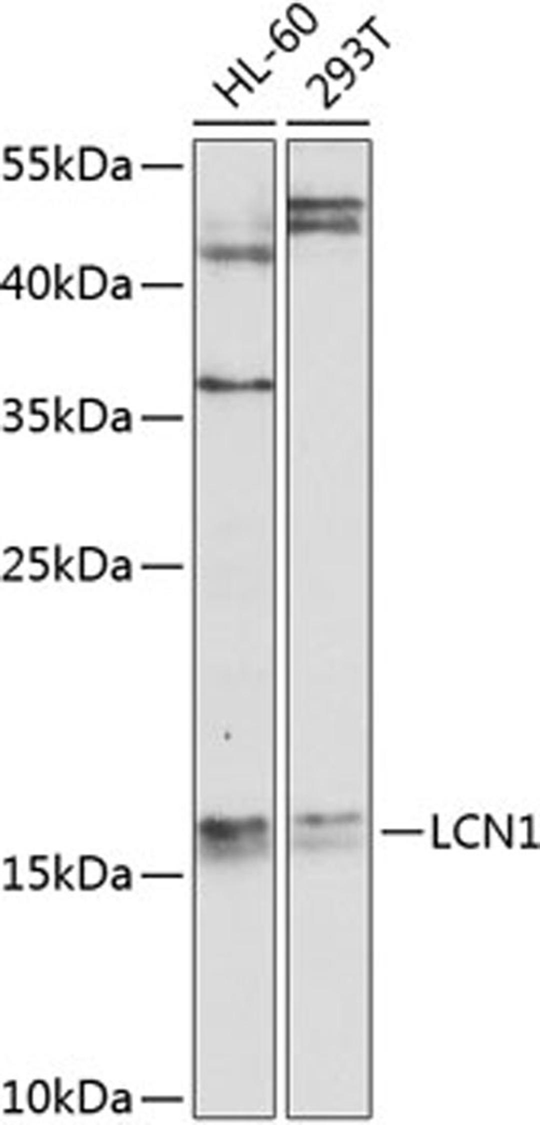 Western blot - LCN1 antibody (A9828)