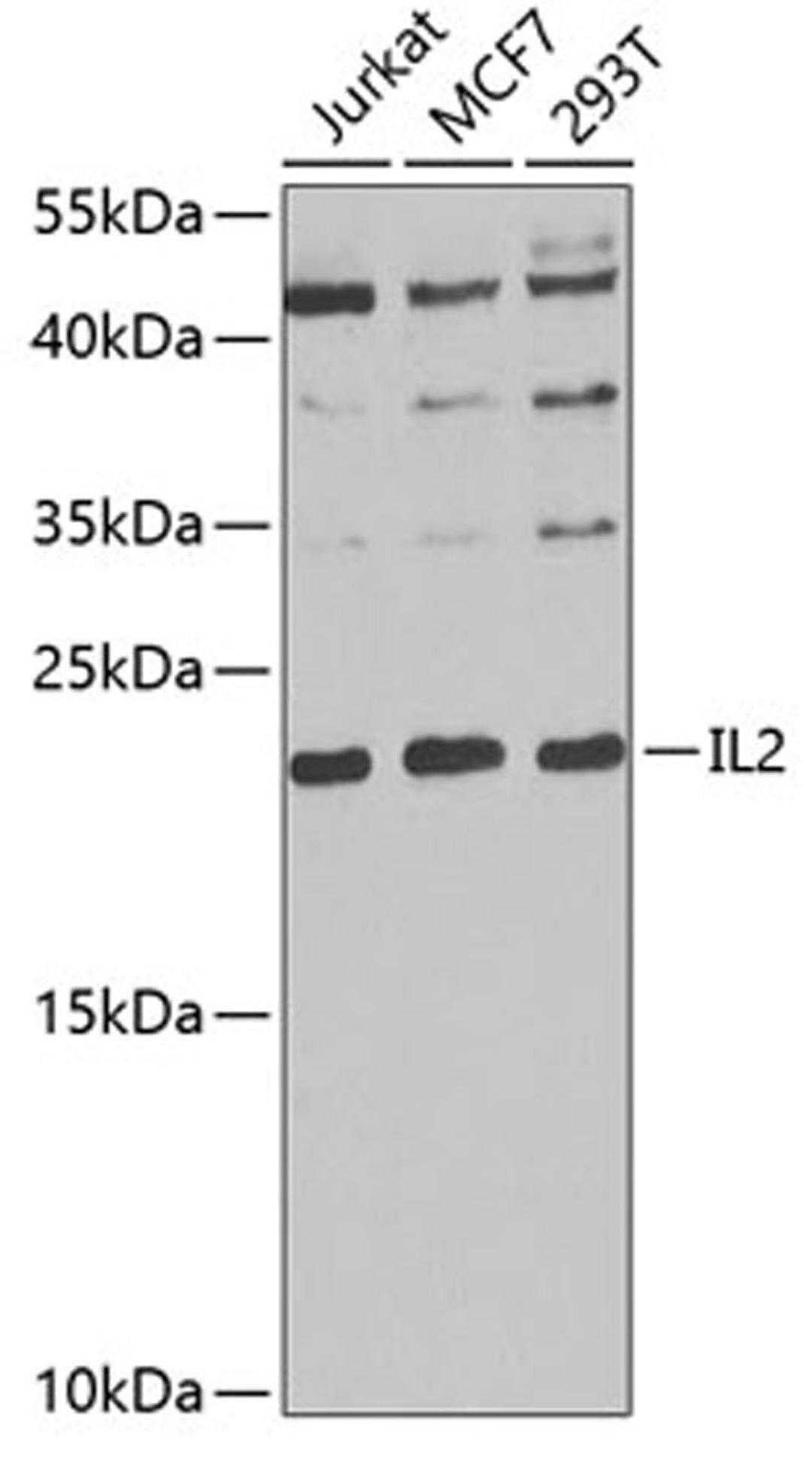 Western blot - IL2 antibody (A0302)