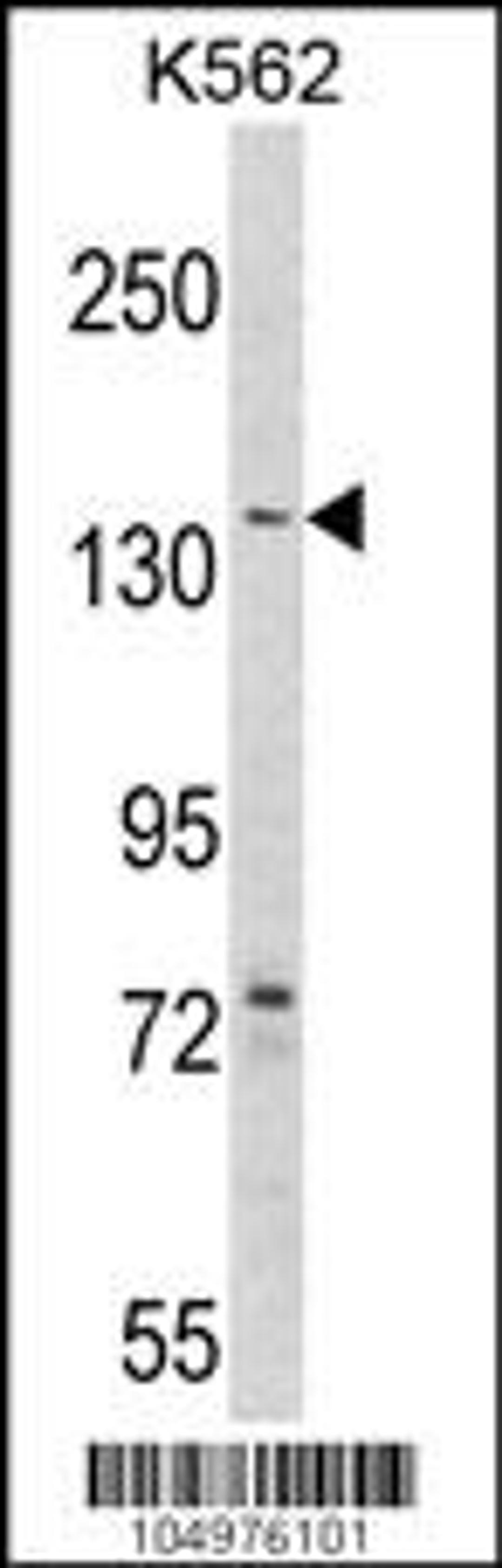 Western blot analysis of hAGL-C371 in K562 cell line lysates (35ug/lane)