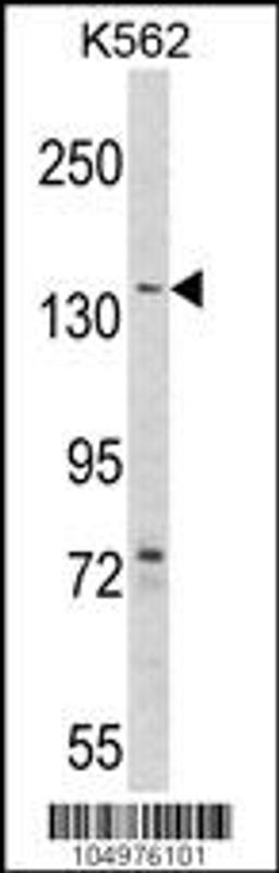 Western blot analysis of hAGL-C371 in K562 cell line lysates (35ug/lane)