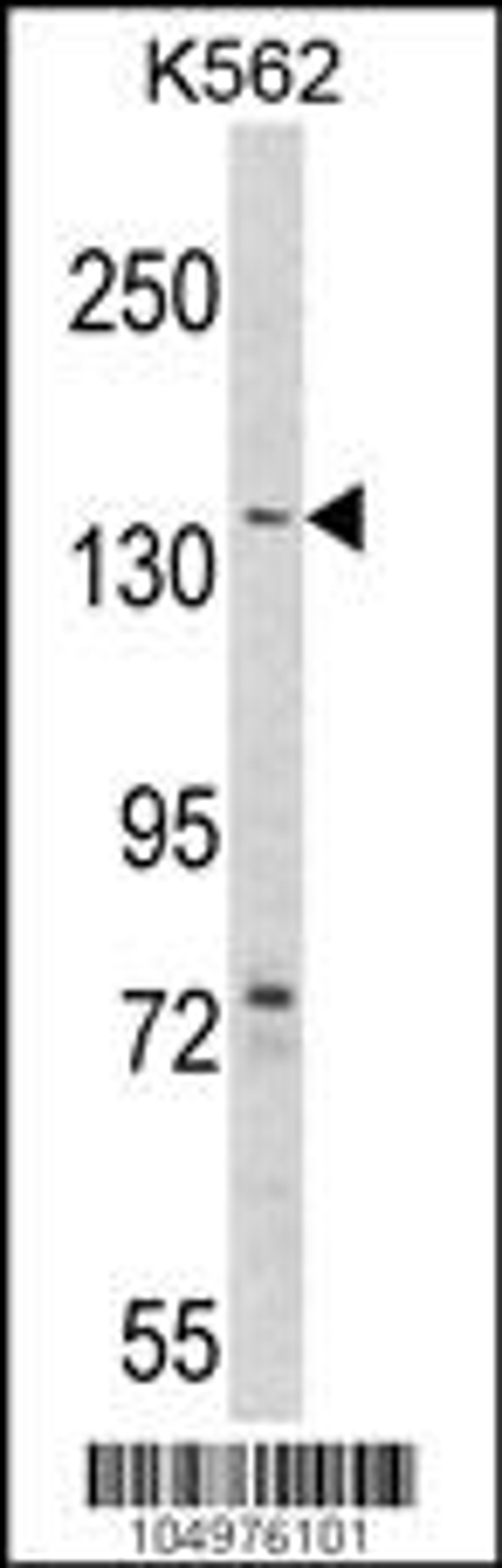 Western blot analysis of hAGL-C371 in K562 cell line lysates (35ug/lane)