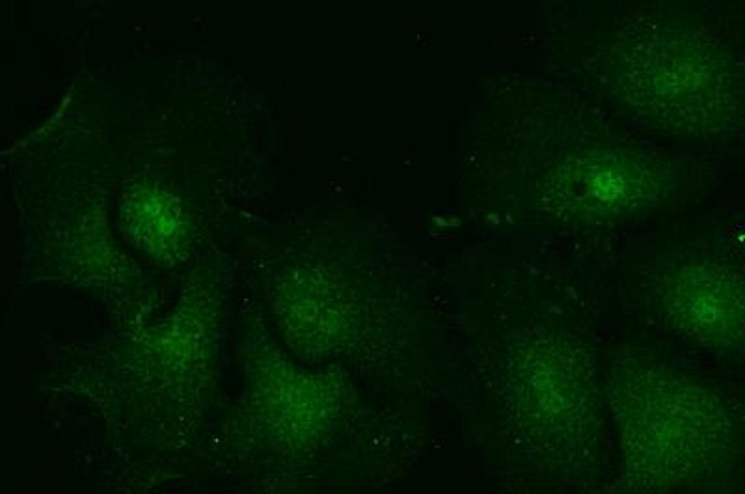 Immunocytochemistry/Immunofluorescence: Rab5a Antibody [NB120-13253] - IF staining of Rab5a in hepatocytes. Image from verified customer review.