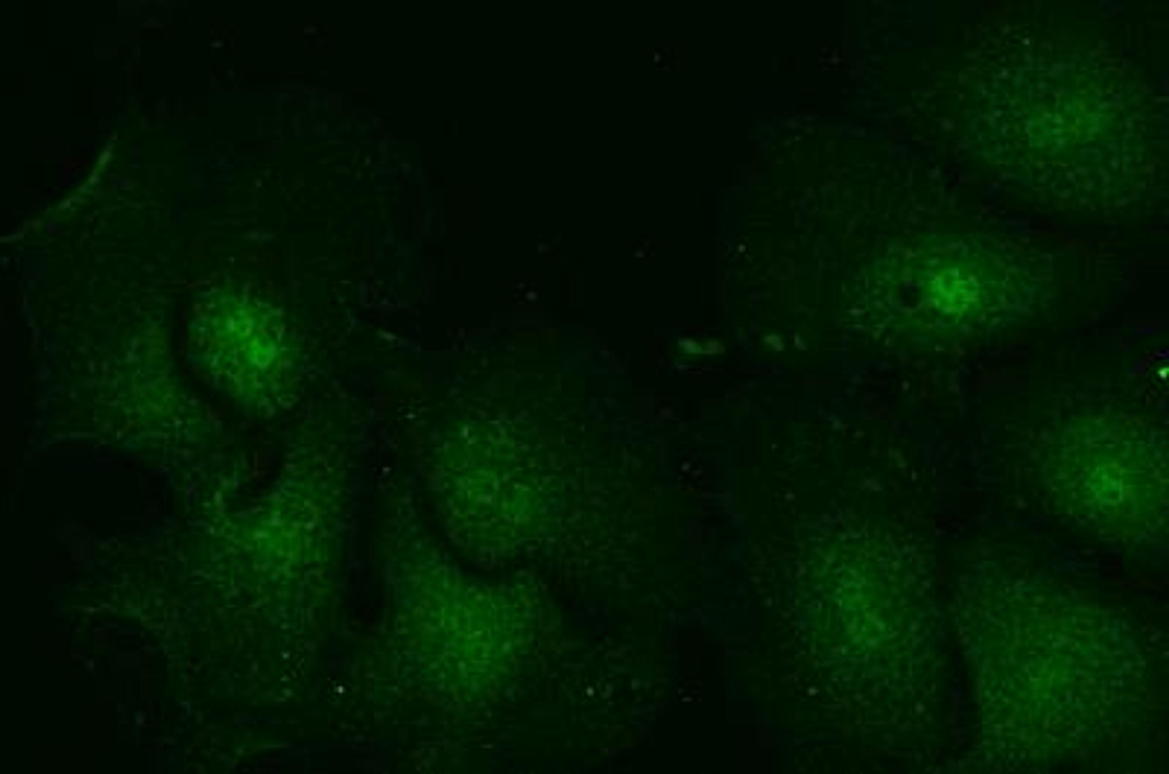 Immunocytochemistry/Immunofluorescence: Rab5a Antibody [NB120-13253] - IF staining of Rab5a in hepatocytes. Image from verified customer review.