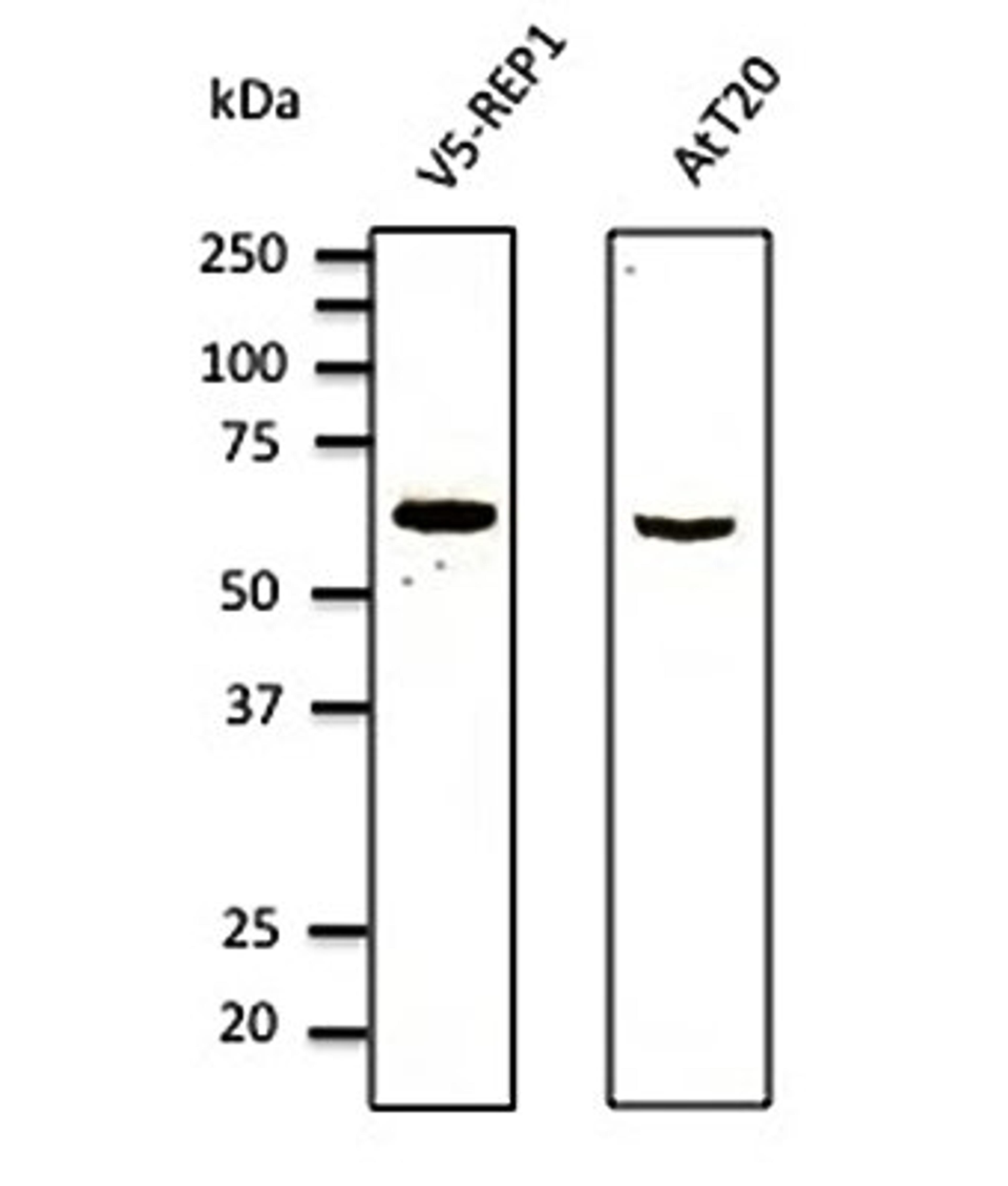 Western blot analysis of HEK293 and At-T20 cell line lysate using REP1 antibody.