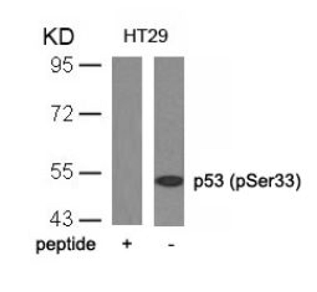 Western blot analysis of lysed extracts from HT29 cells using p53 (Phospho-Ser33).