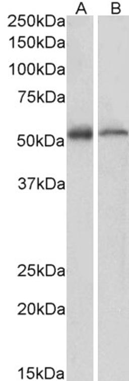 45-553 (1ug/ml) staining of Human (A) and Mouse (B) Thymus lysate (35ug protein in RIPA buffer). Primary incubation was 1 hour. Detected by chemiluminescence.