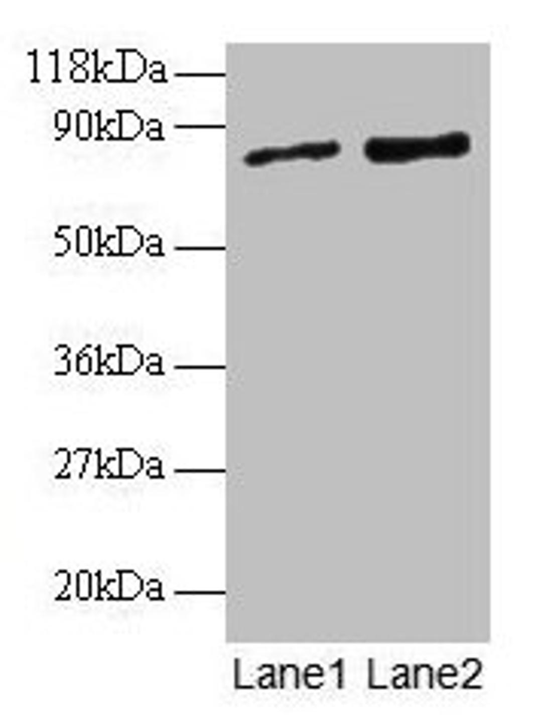 Western blot. All lanes: RAB1A antibody at 2µg/ml. Lane 1: EC109 whole cell lysate. Lane 2: 293T whole cell lysate. Secondary. Goat polyclonal to rabbit IgG at 1/15000 dilution. Predicted band size: 23, 16, 14 kDa. Observed band size: 80 kDa