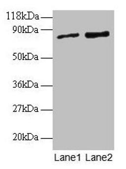 Western blot. All lanes: RAB1A antibody at 2µg/ml. Lane 1: EC109 whole cell lysate. Lane 2: 293T whole cell lysate. Secondary. Goat polyclonal to rabbit IgG at 1/15000 dilution. Predicted band size: 23, 16, 14 kDa. Observed band size: 80 kDa