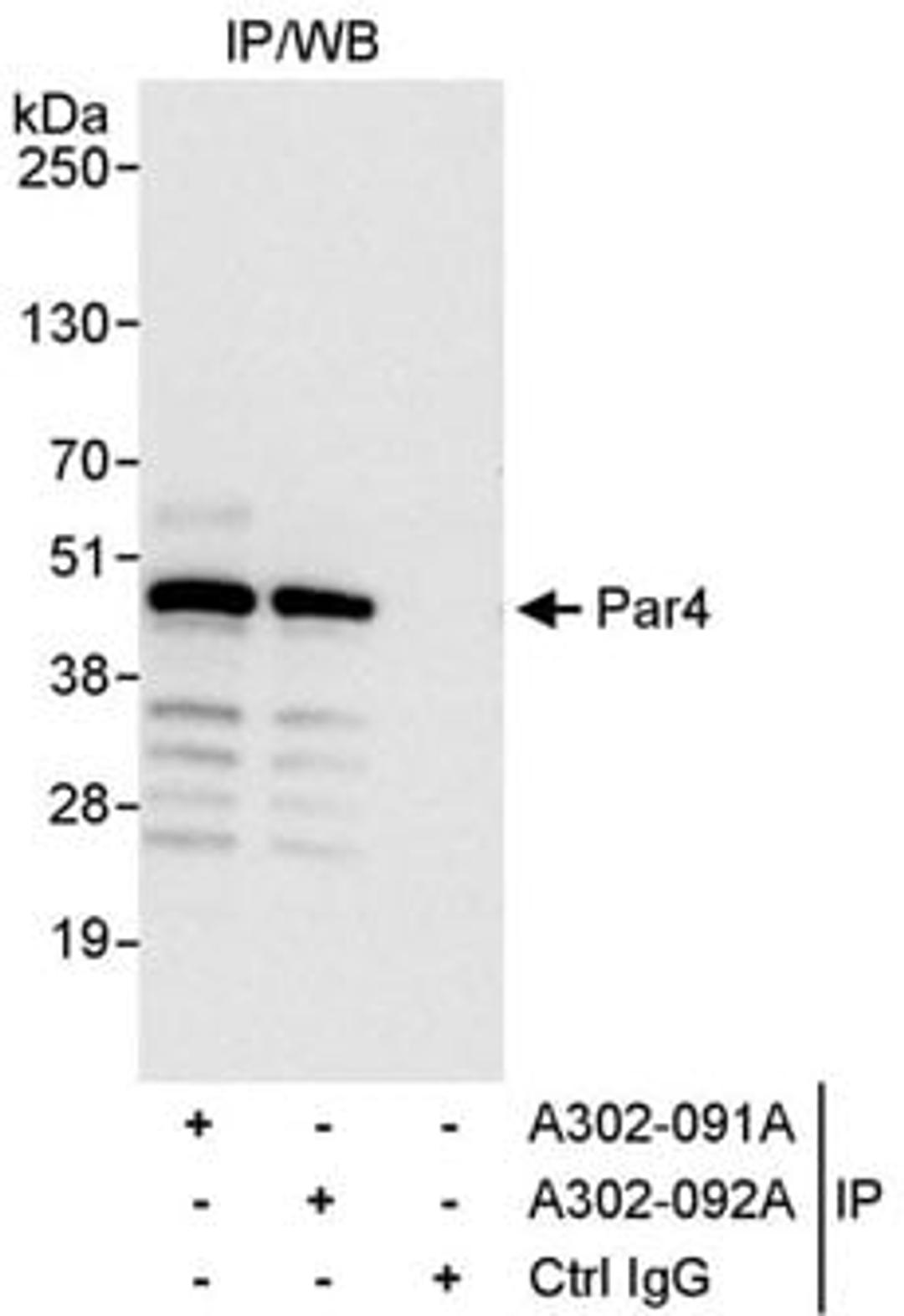 Detection of human Par4 by western blot and immunoprecipitation.