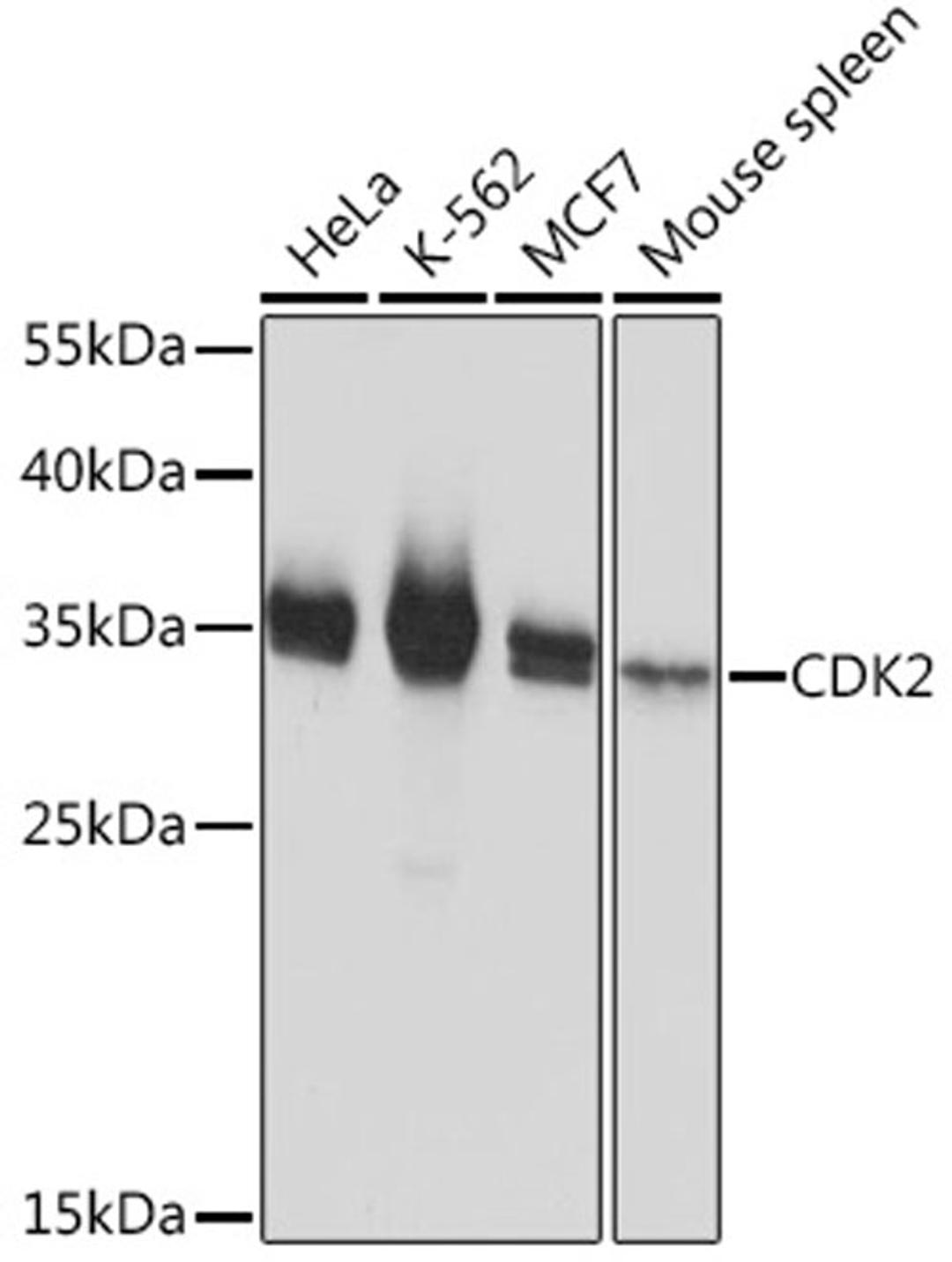 Western blot - CDK2 Rabbit pAb (A16885)