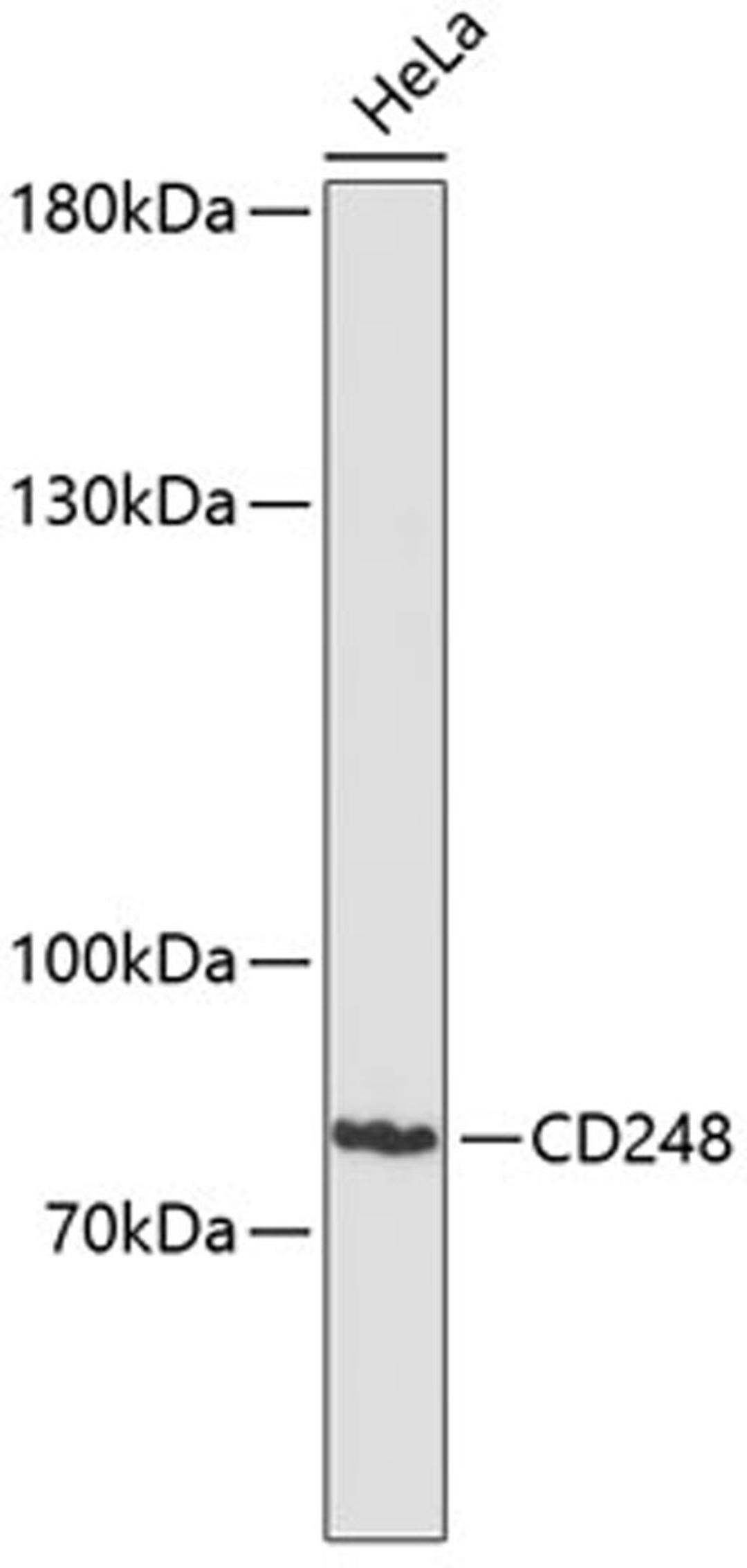 Western blot - CD248 antibody (A12706)