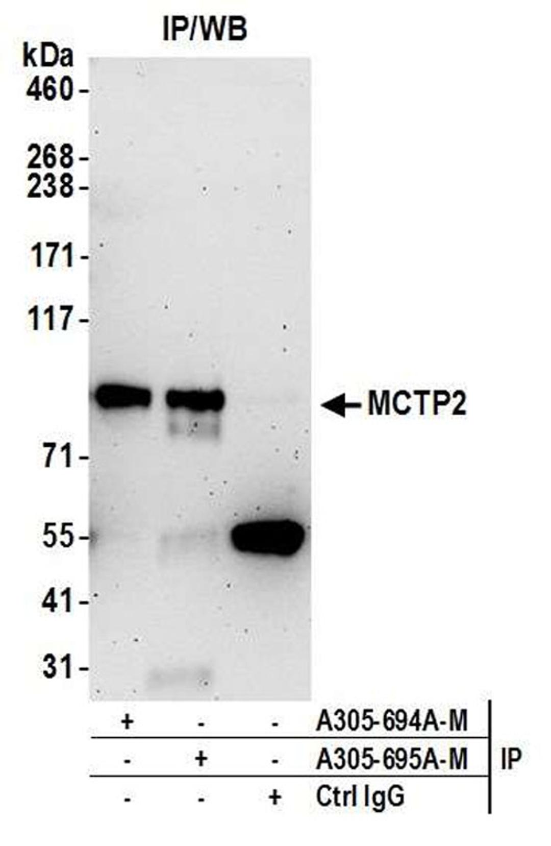 Detection of human MCTP2 by WB of IP.