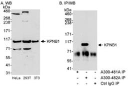 Detection of KPNB1 by western blot and immunoprecipitation.