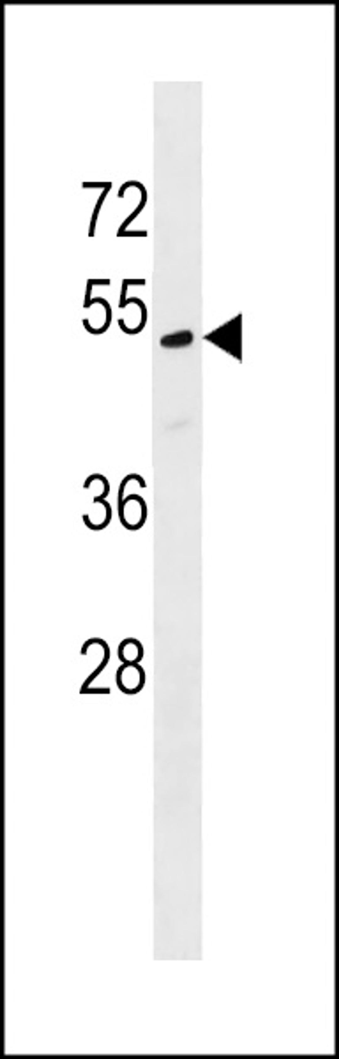 Western blot analysis in WiDr cell line lysates (35ug/lane).