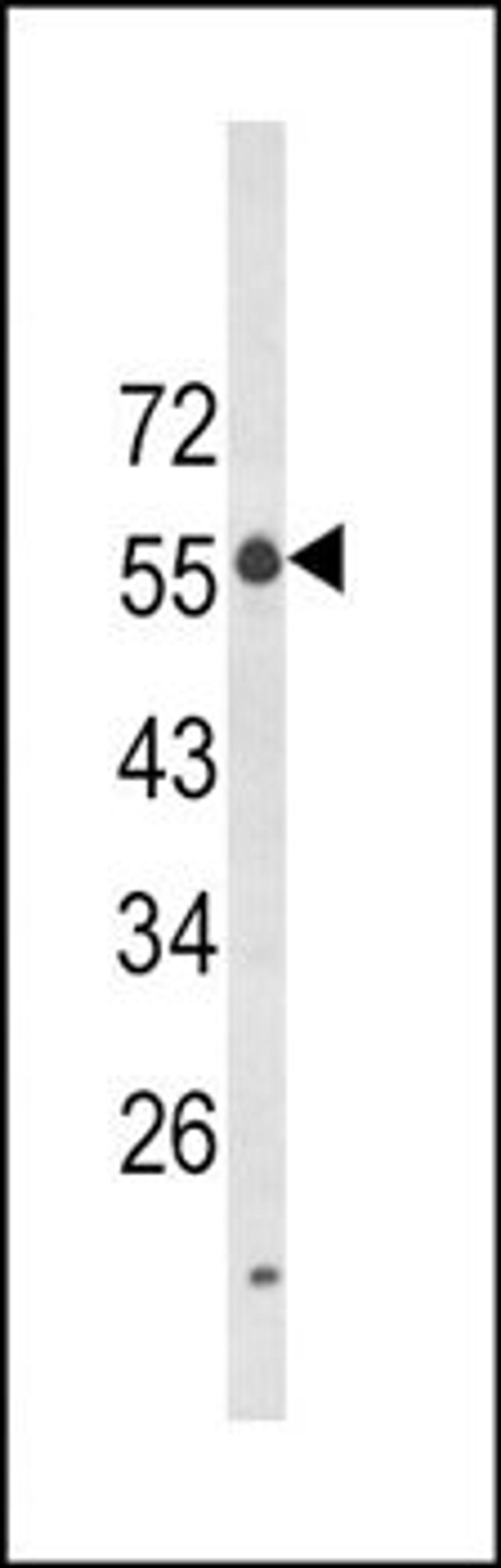 Western blot analysis of K562 cell line lysates (35ug/lane) using LAG3 antibody