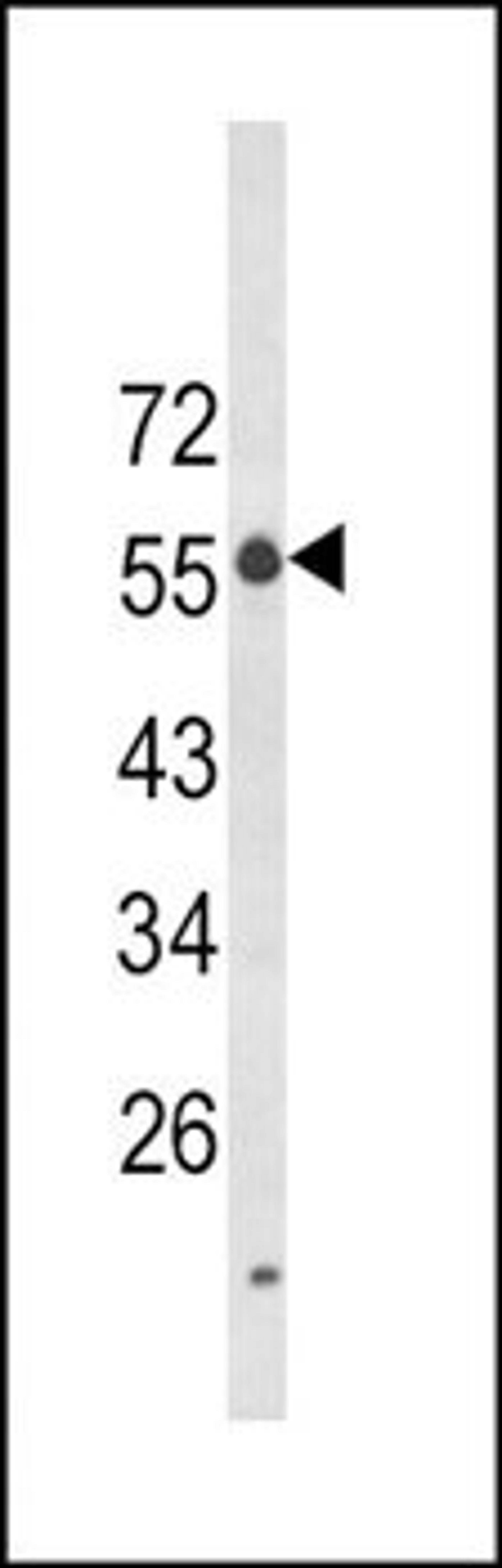 Western blot analysis of K562 cell line lysates (35ug/lane) using LAG3 antibody