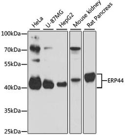 Western blot - ERP44 antibody (A4526)