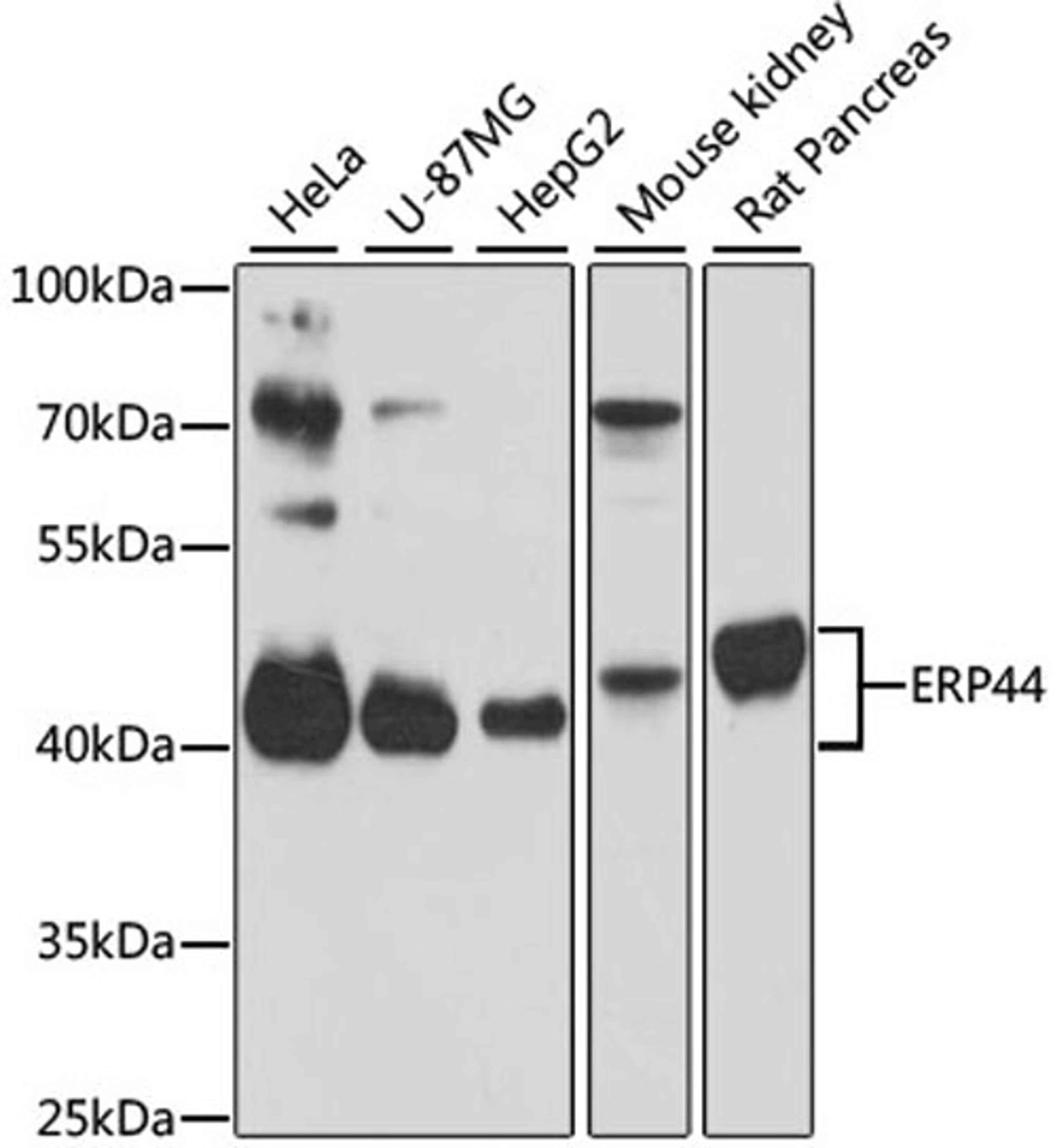 Western blot - ERP44 antibody (A4526)