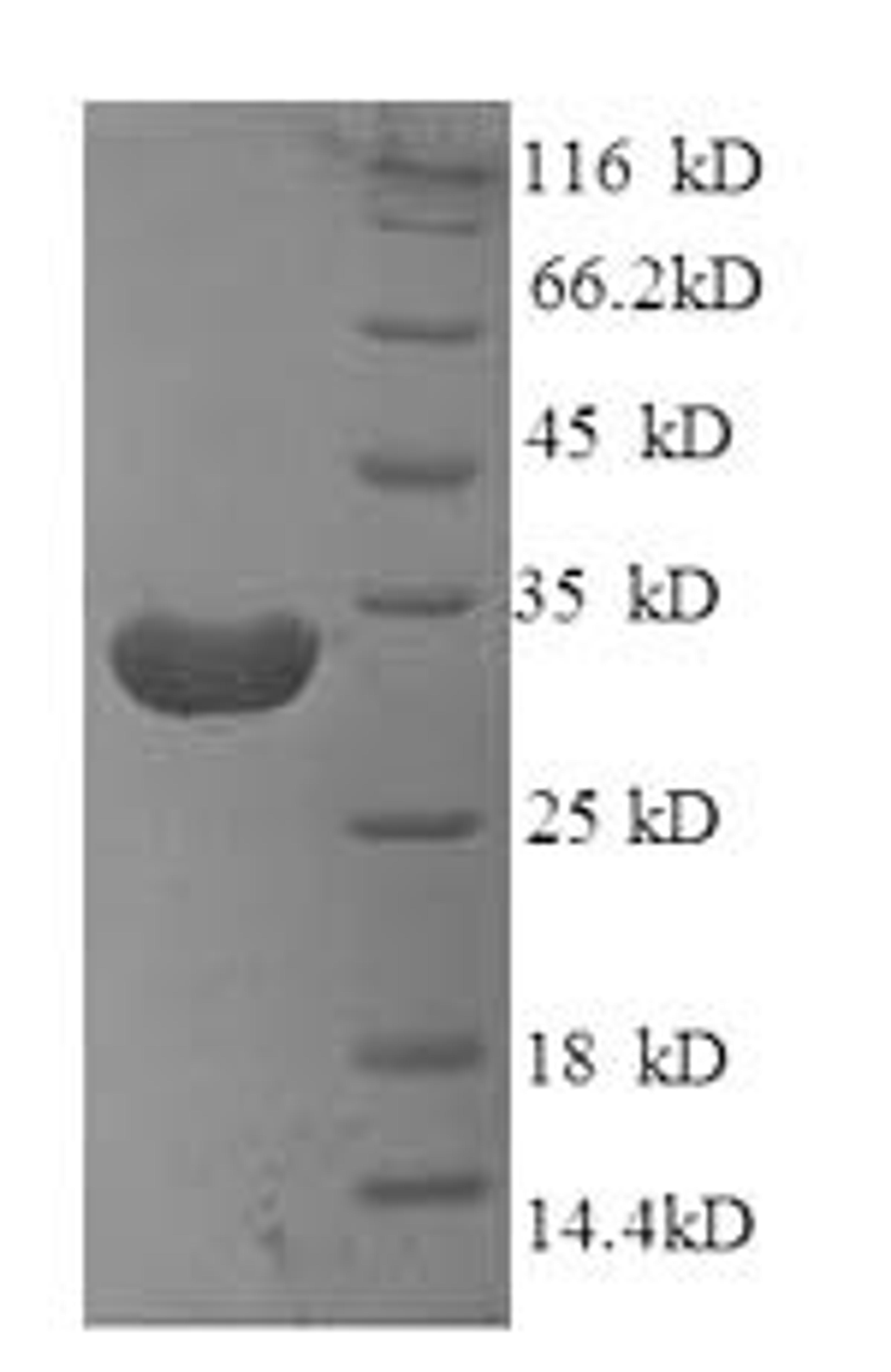 (Tris-Glycine gel) Discontinuous SDS-PAGE (reduced) with 5% enrichment gel and 15% separation gel.