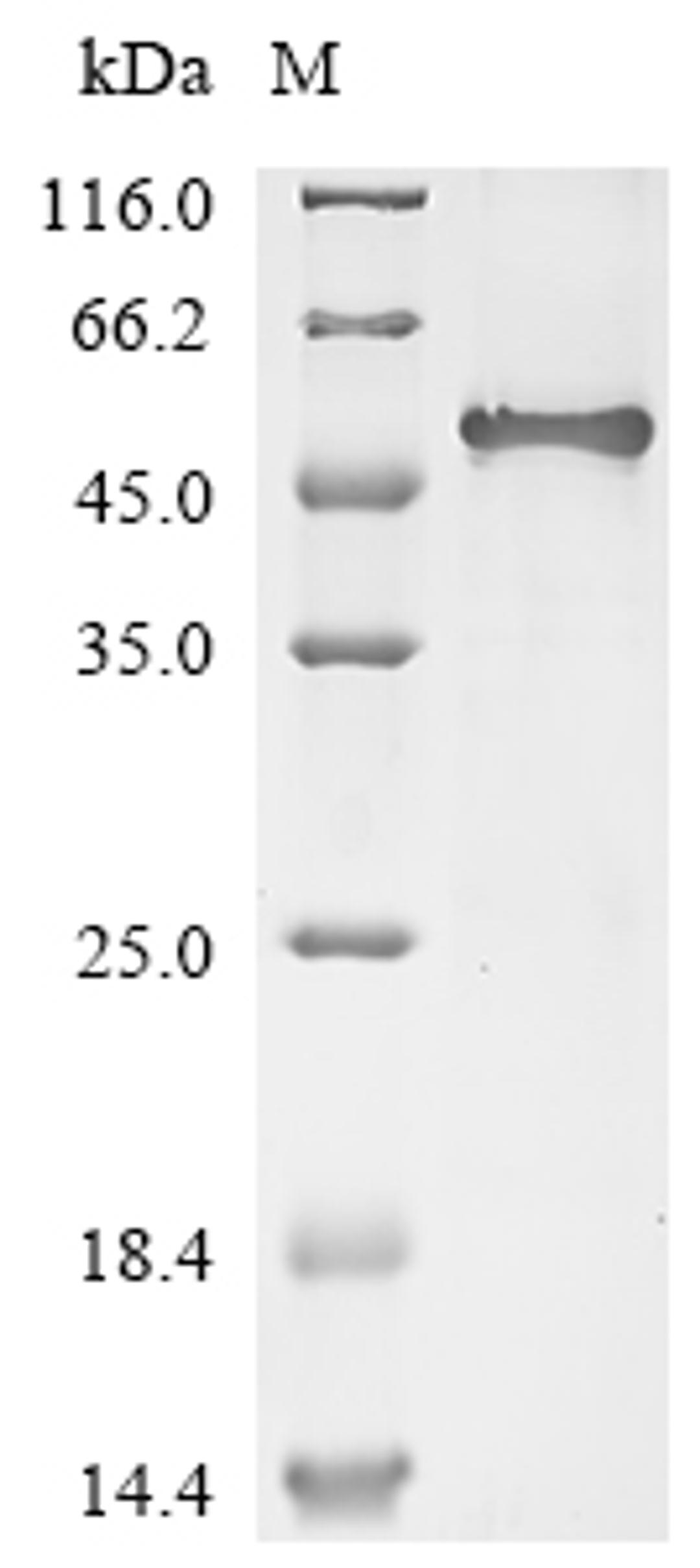 (Tris-Glycine gel) Discontinuous SDS-PAGE (reduced) with 5% enrichment gel and 15% separation gel.