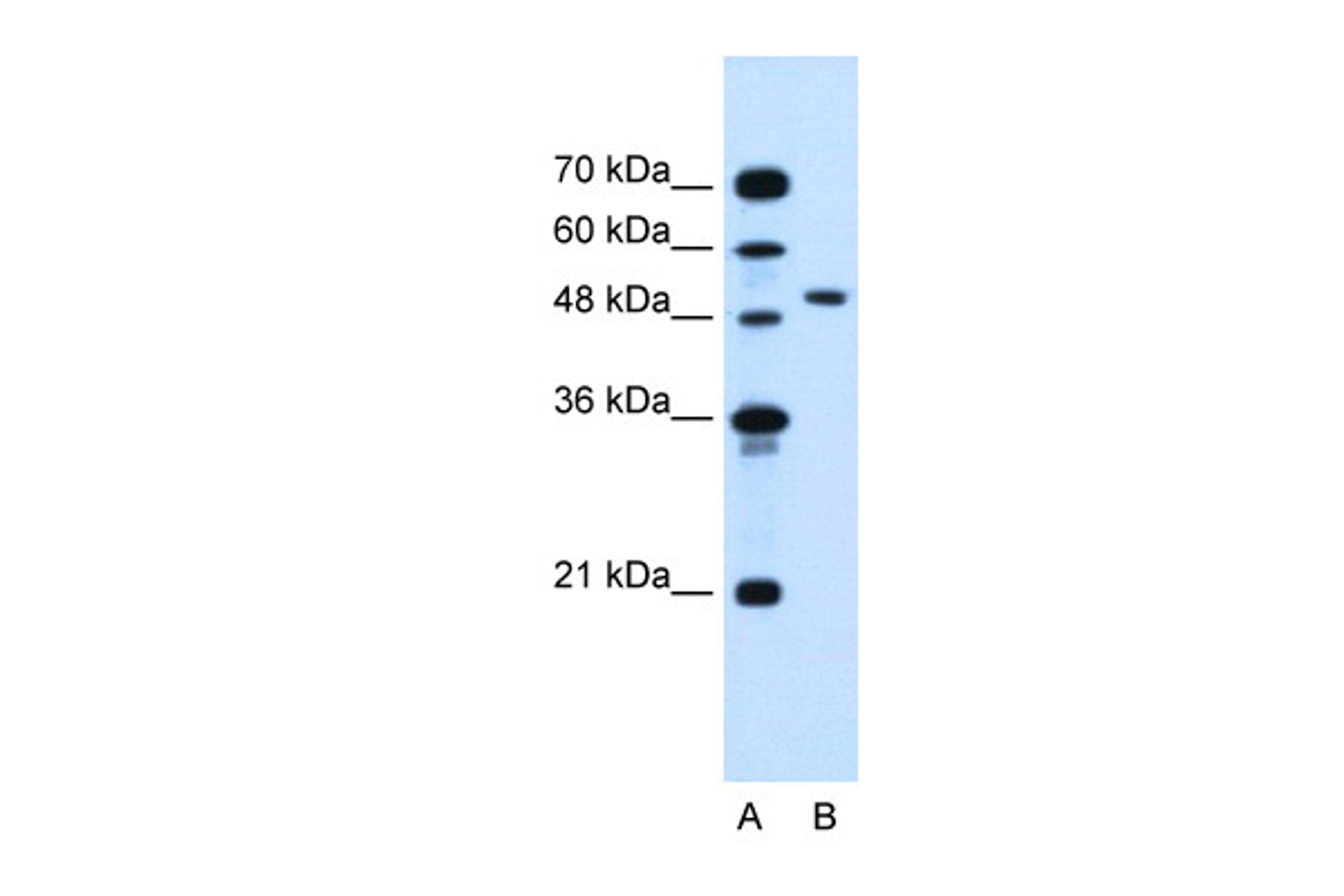 Antibody used in WB on Human Jurkat 0.5 ug/ml.